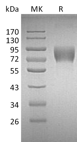 Human DNAM-1 +SDS-PAGE-1.jpg